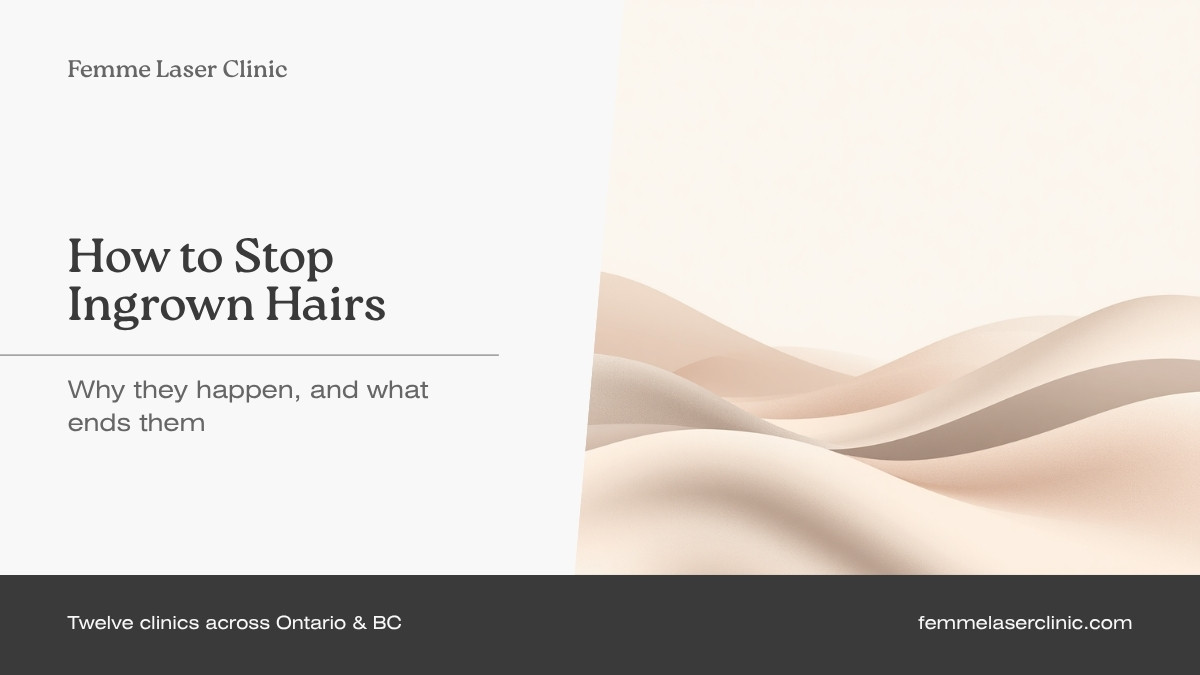 Femme Laser Clinic article header reading "How to stop ingrown hairs: why they happen, and what ends them"