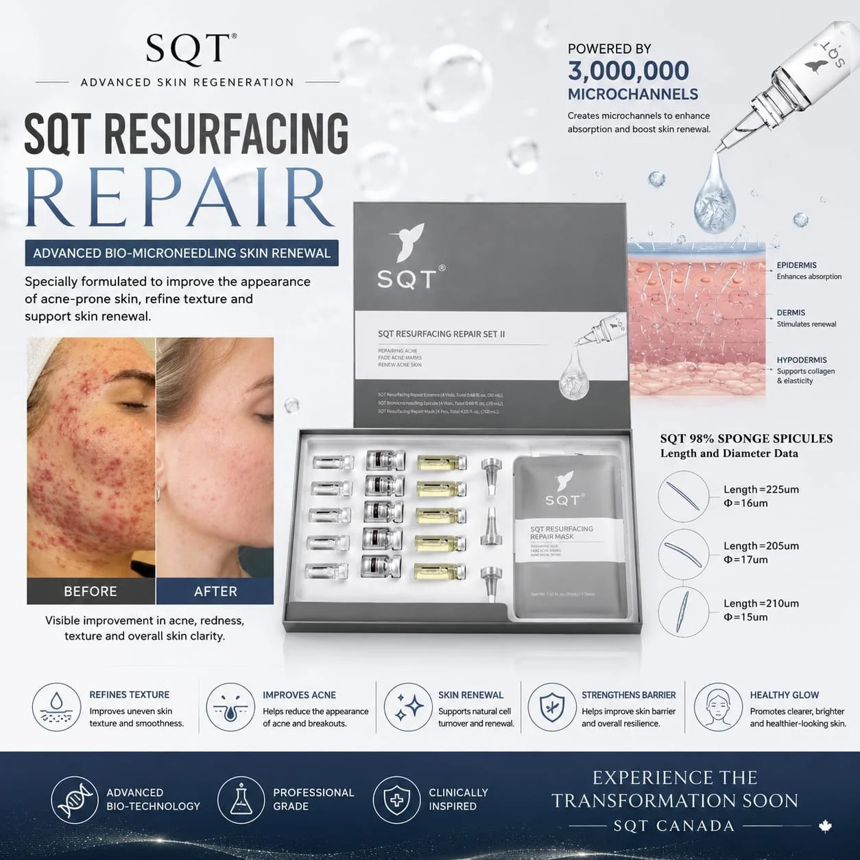 The SQT Resurfacing Repair Set II — essence vials, spicule ampoules and sheet mask — alongside spicule measurements of roughly 205 to 225 microns long and 15 to 17 microns across.