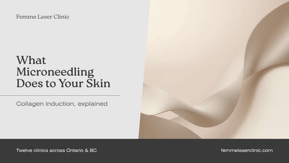 Femme Laser Clinic article header reading "What microneedling does to your skin: collagen induction, explained"
