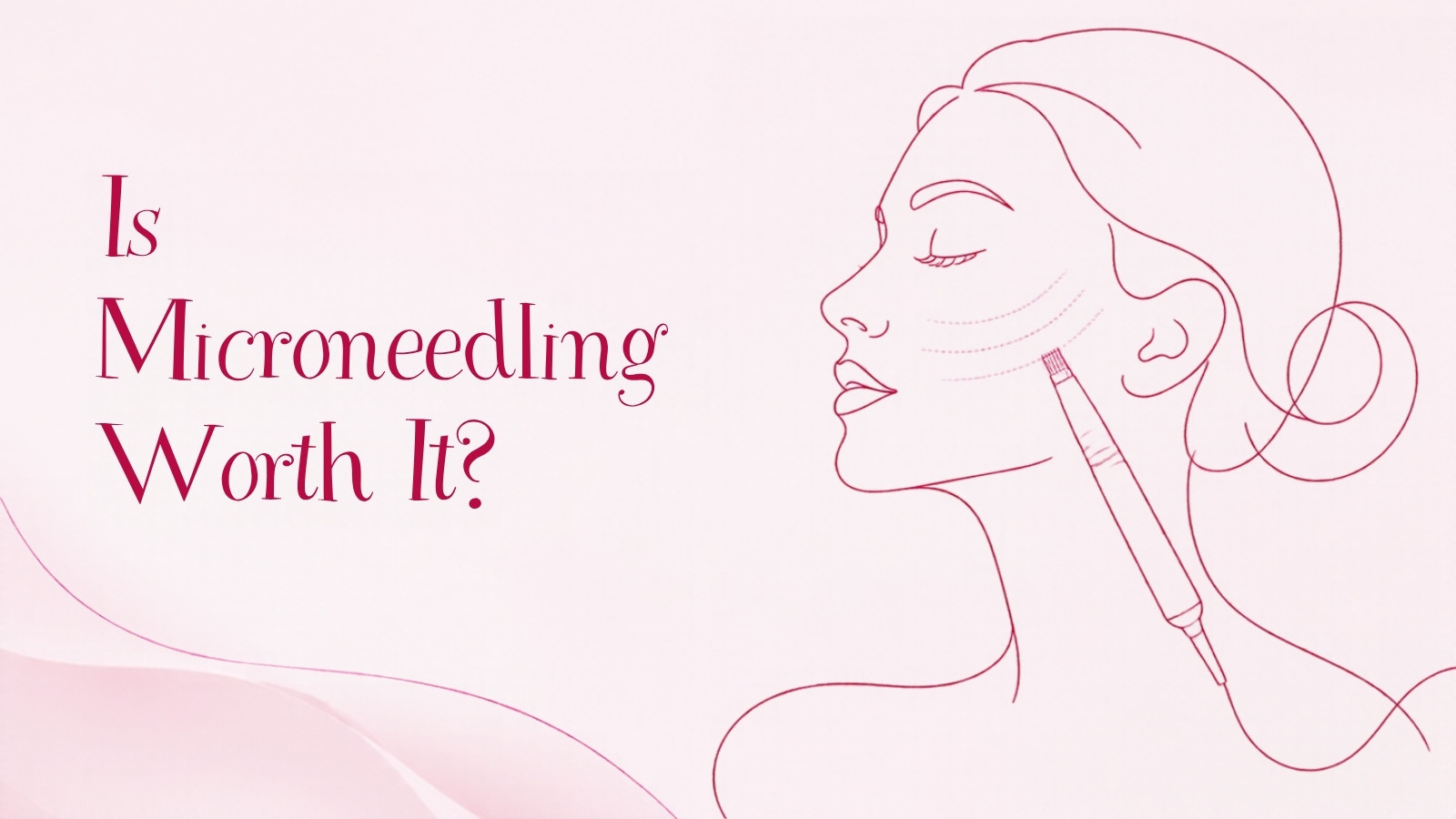 Line drawing of a woman in profile with a microneedling pen at her cheek, for an article on whether microneedling is worth it