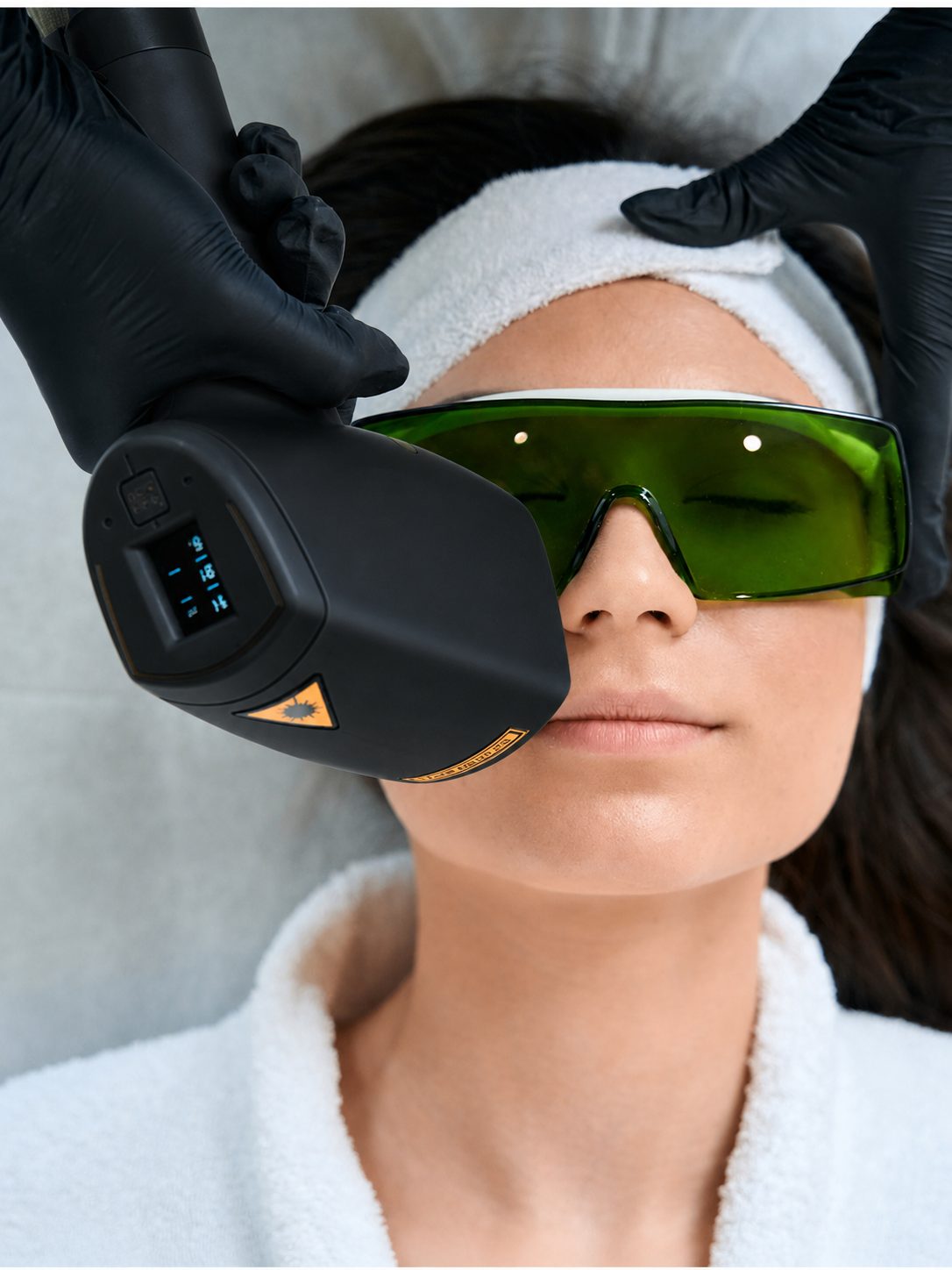 Facial laser hair removal treatment with protective goggles