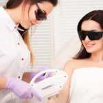 a women getting her arms laser hair removal