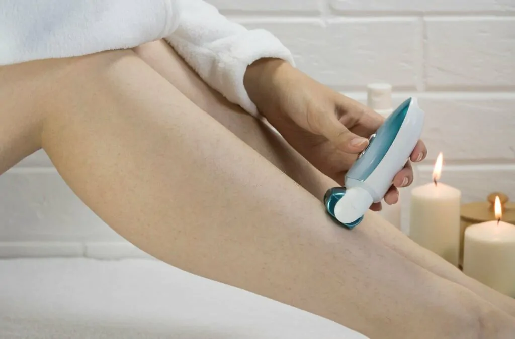 Get Rid of Strawberry Legs: How Laser Hair Removal Helps