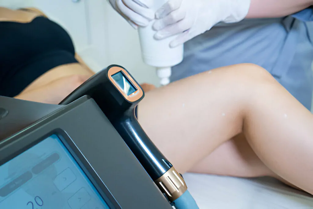 laser-hair-removal-vaughan